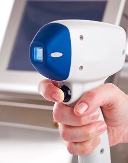 Laser-Haarentfernung